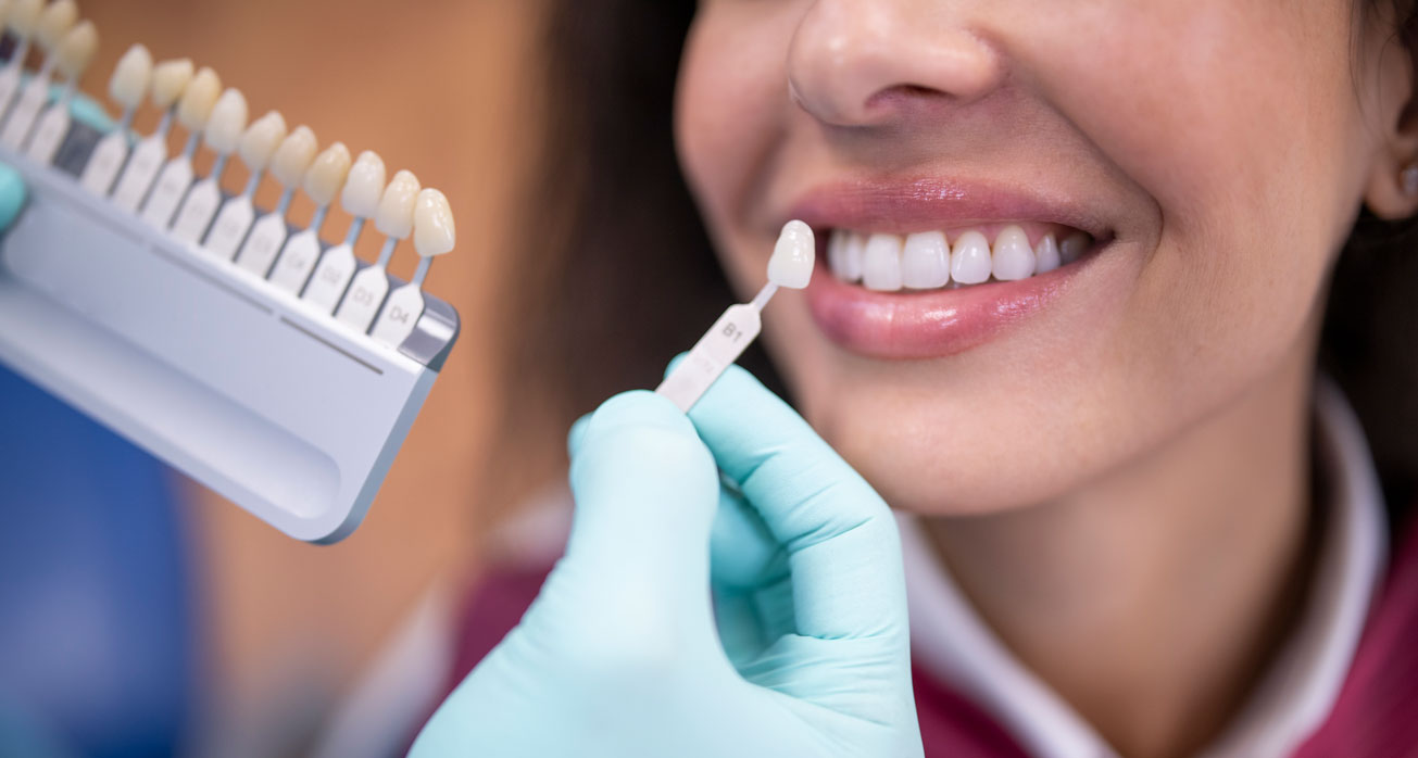 Are Veneers Right For Me? Exploring Benefits, Types, and Your Options