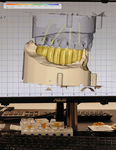 Dental Laboratory