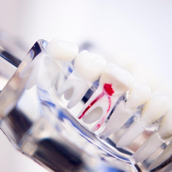 What is endodontics?