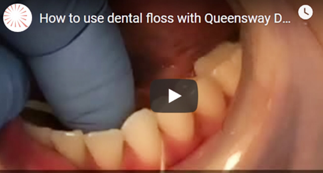 Watch our latest video on how to use dental floss!