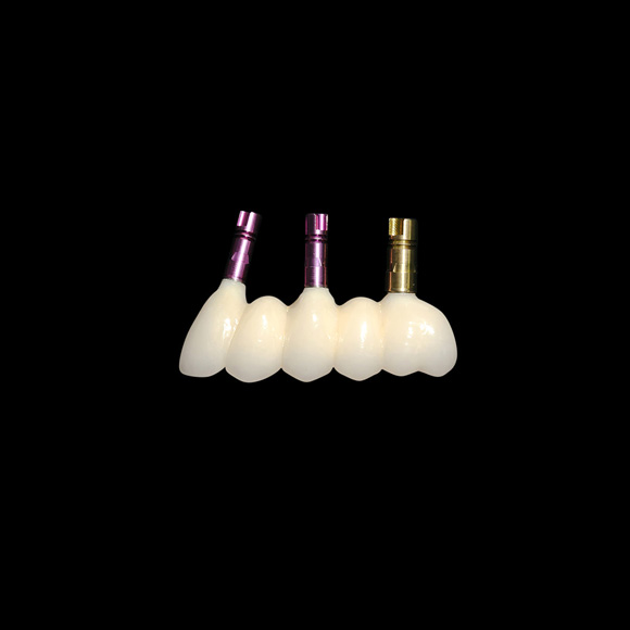 Types of dentures