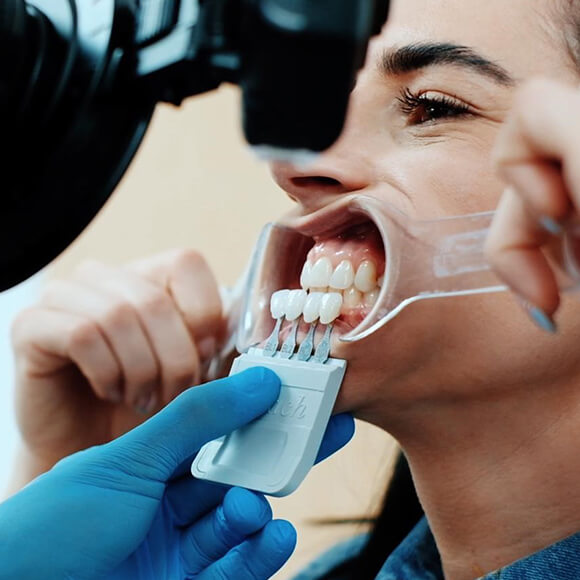 What is tooth
whitening treatment?