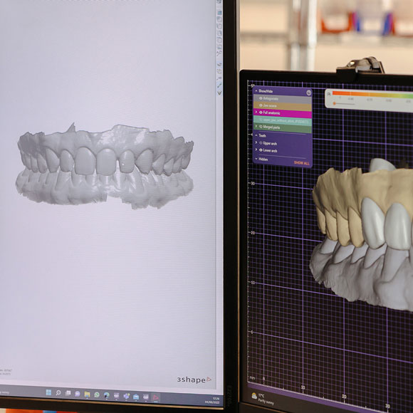 Why choose Queensway Dental Washington? Why choose Queensway Dental Washington?
