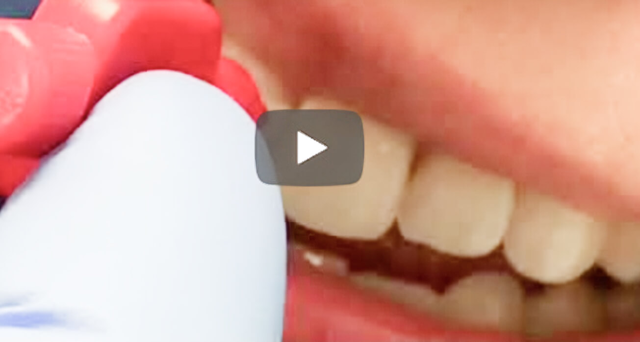 Watch this short video on how to use interdental brushes!