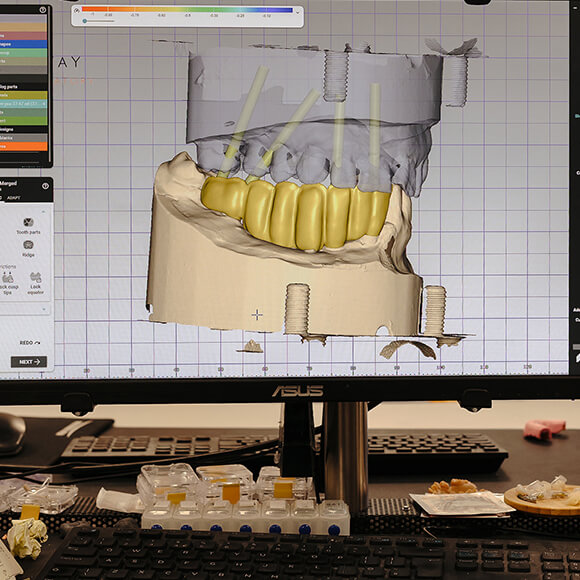 Digital imaging -
CBCT referrals