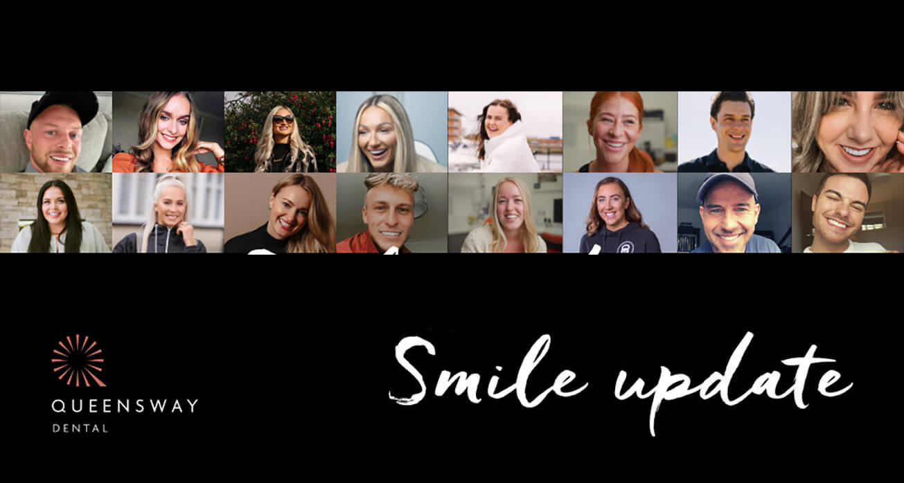 Smile update | August 2022