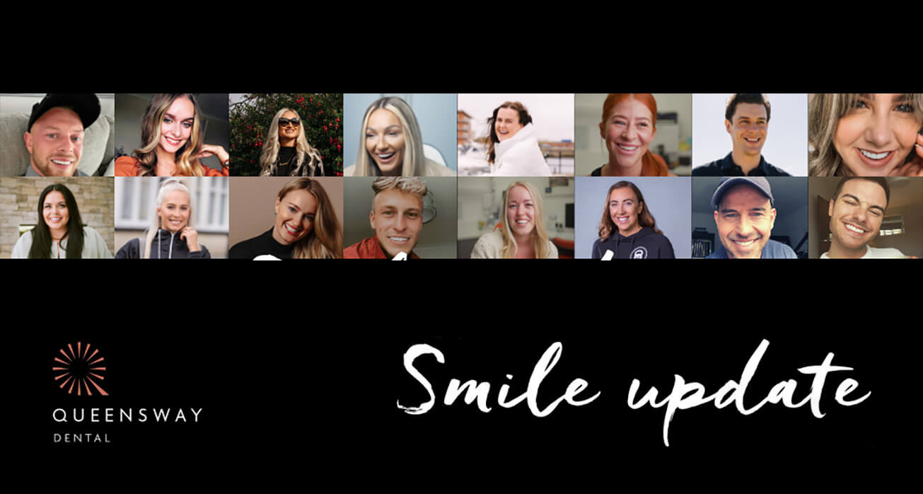 Smile update | October 2022