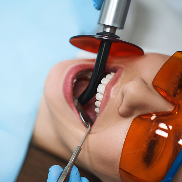 How does root
canal treatment work? How does root
canal treatment work?