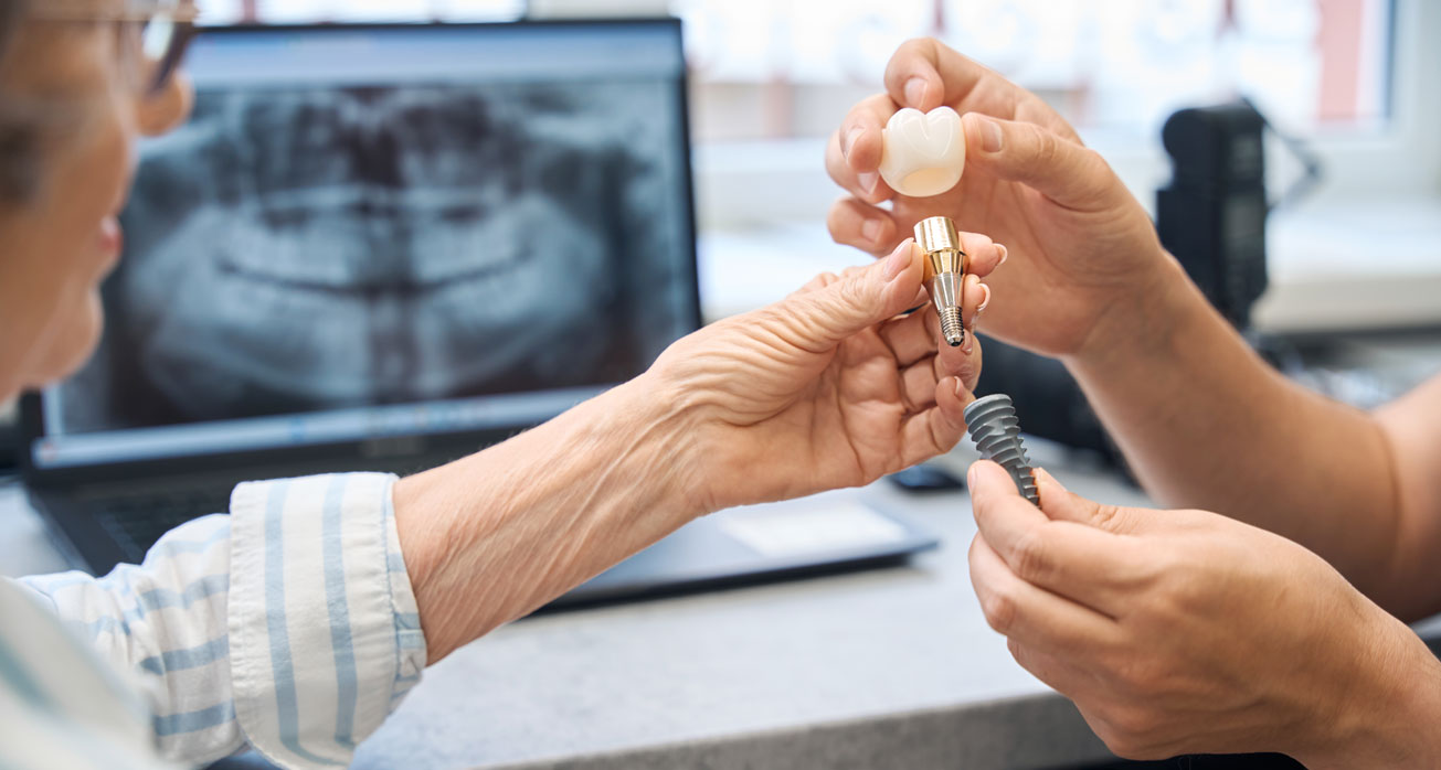 Dental Implants Vs Dentures: Which Is Best For You?