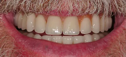 After treatment at Queensway Dental