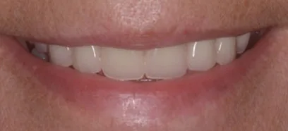 After treatment at Queensway Dental