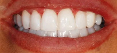 After treatment at Queensway Dental
