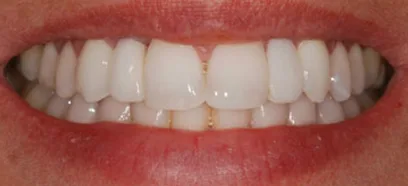 After treatment at Queensway Dental
