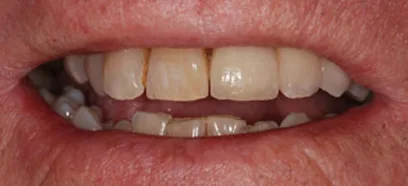 After treatment at Queensway Dental