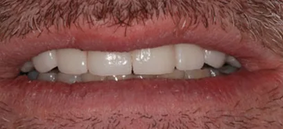 After treatment at Queensway Dental