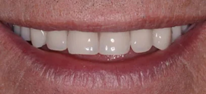 After treatment at Queensway Dental