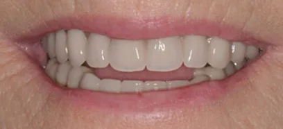 After treatment at Queensway Dental