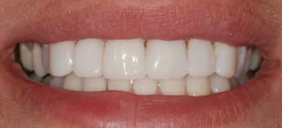 After treatment at Queensway Dental