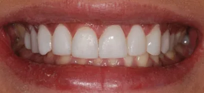 After treatment at Queensway Dental