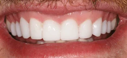 After treatment at Queensway Dental