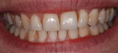 After treatment at Queensway Dental