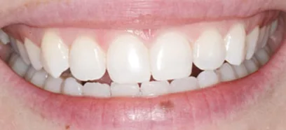 After treatment at Queensway Dental