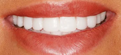 After treatment at Queensway Dental