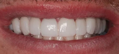 After treatment at Queensway Dental