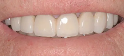After treatment at Queensway Dental