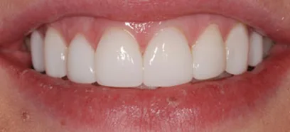 After treatment at Queensway Dental