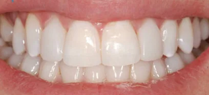 After treatment at Queensway Dental