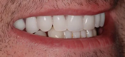 After treatment at Queensway Dental
