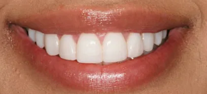 After treatment at Queensway Dental