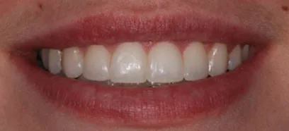 After treatment at Queensway Dental
