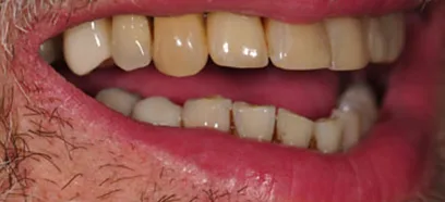 After treatment at Queensway Dental
