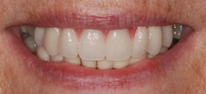 After treatment at Queensway Dental