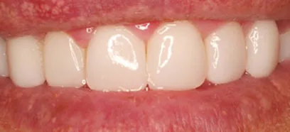 After treatment at Queensway Dental
