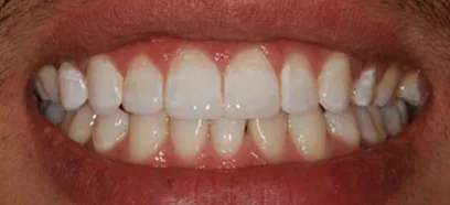 After treatment at Queensway Dental