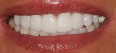 After treatment at Queensway Dental