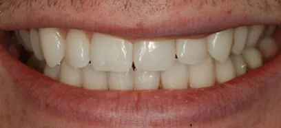 After treatment at Queensway Dental