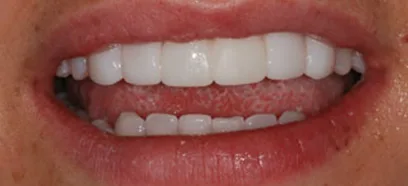 After treatment at Queensway Dental