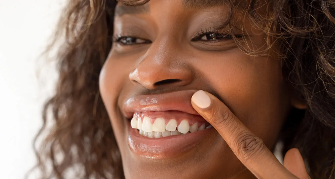 I Have a Gummy Smile, What Are My Options? I Have a Gummy Smile, What Are My Options?
