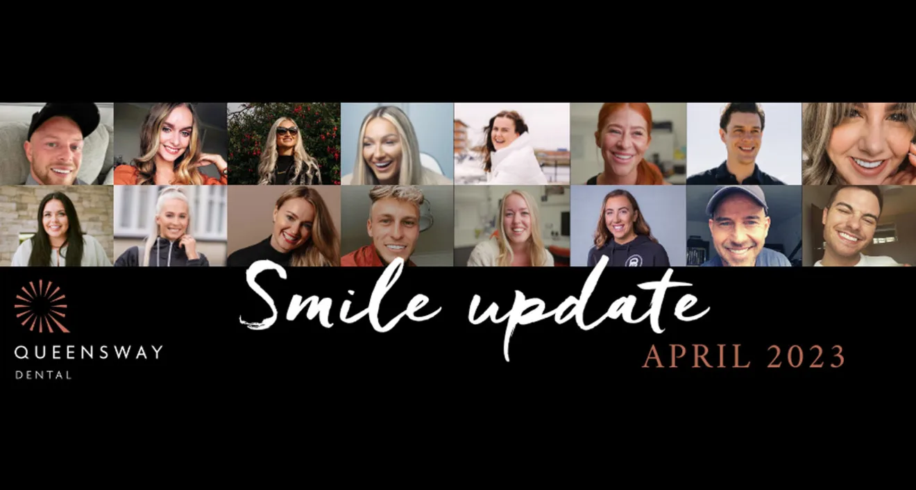 Smile update | April 2023 Smile update | April 2023