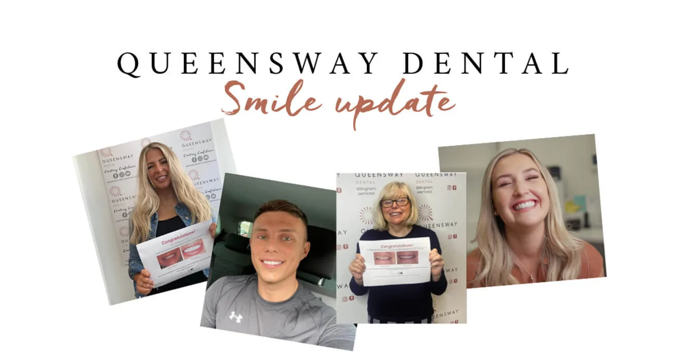 Smile update | August 2021 Smile update | August 2021