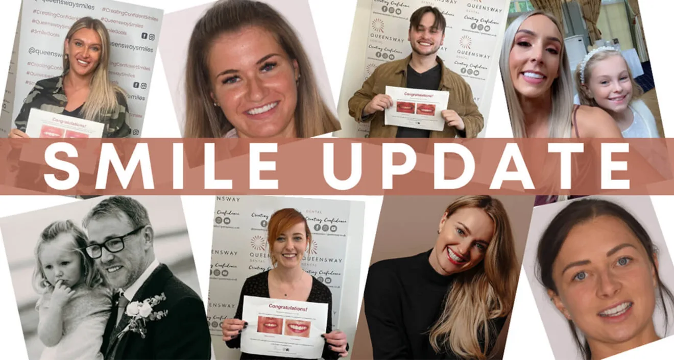 Smile update | March 2022 Smile update | March 2022