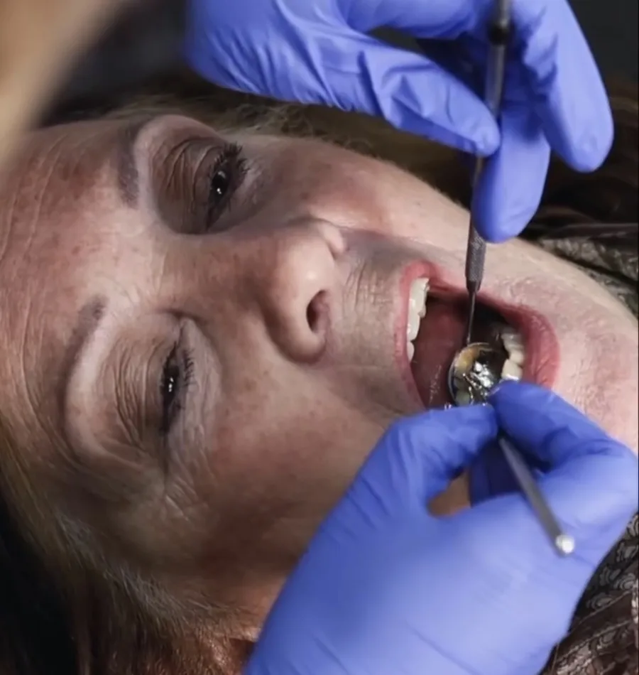 A dental hygiene appointment in progress A dental hygiene appointment in progress