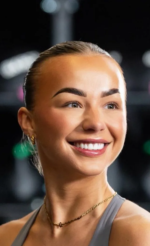 Queenie, a Queensway Dental patient, after Composite Veneers Queenie, a Queensway Dental patient, after Composite Veneers