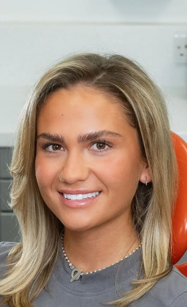 Sienna, a Queensway Dental patient, after Tooth Whitening & Composite Veneers Sienna, a Queensway Dental patient, after Tooth Whitening & Composite Veneers