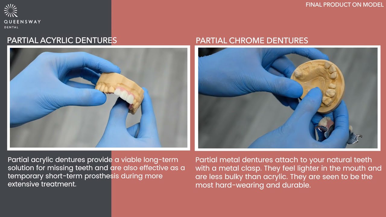 Queensway Dental dentures patient story
