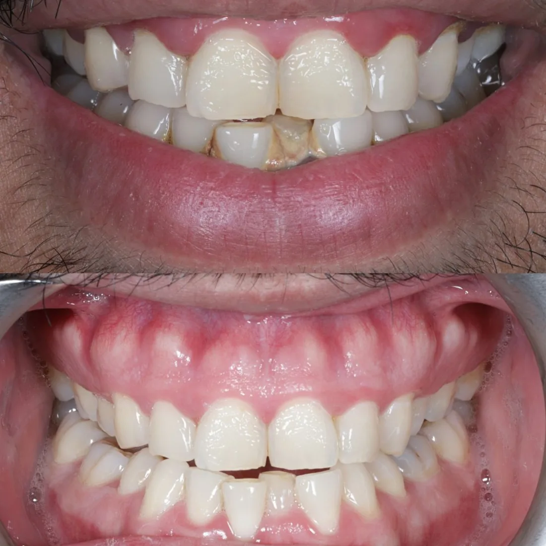 Specialist periodontal assessment at Queensway Dental
